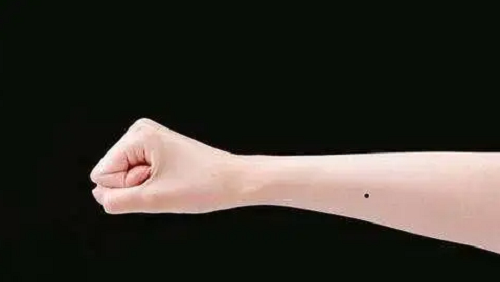 右手手臂有痣代表什么女人,右手手臂有痣代表什么